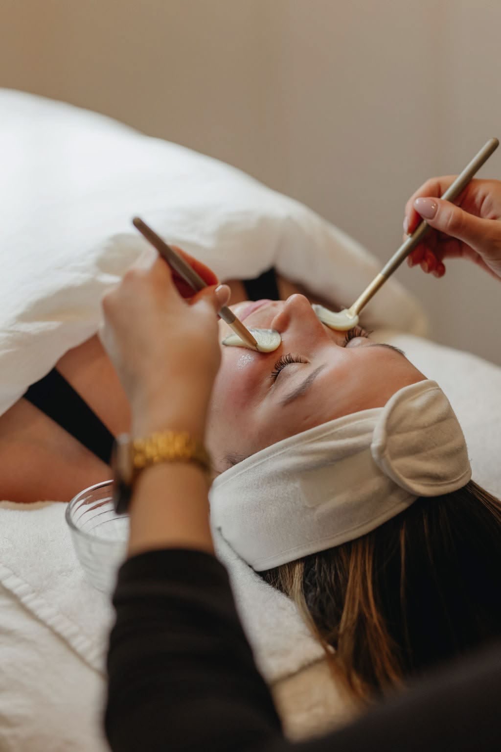 Peeling — Renovación Celular en Skinergy